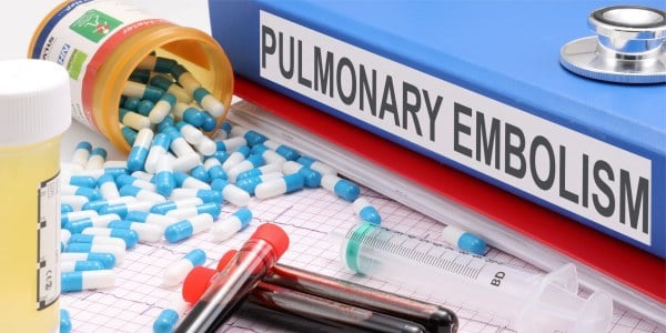 pulmonary embolism